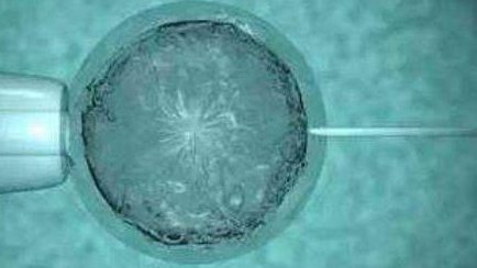 哈萨克斯坦三代试管婴儿医院排名公布附详细成功率